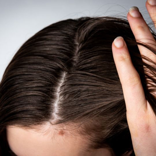 Hiuspohja on hiusten hyvinvoinnin perusta – LV-uutuudet suojaavat ja  kosteuttavat kuivaa hiuspohjaa sekä helpottavat hiusten käsittelyä - Berner  Oy